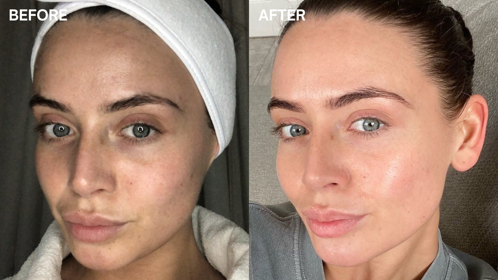 Marine Miracle andlitskrem