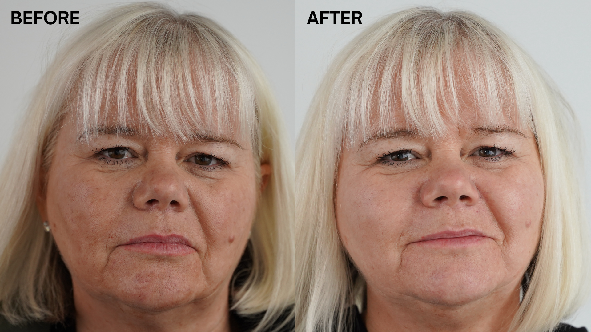 Marine Miracle andlitskrem